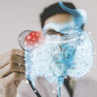 MyBIOME: La nueva frontera en la salud intestinal